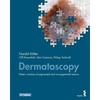 Dermatoscopy: Pattern analysis of pigmented and non-pigmented lesions - Paperback