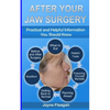 After Your Jaw Surgery: Practical and Helpful Information You Should Know - Paperback