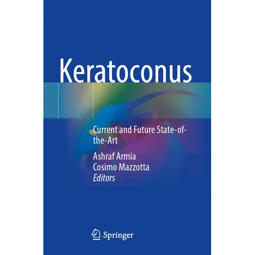 Keratoconus: Current and Future State-Of-The-Art - Paperback