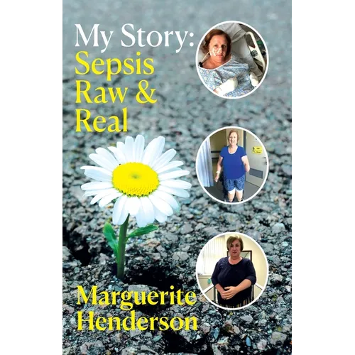 My Story: Sepsis Raw and Real - Paperback