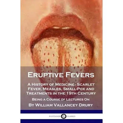 Eruptive Fevers: A History of Medicine - Scarlet Fever, Measles, Small-Pox and Treatments in the 19th Century - Being a Course of Lectures On - Paperback