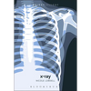 X-Ray - Paperback
