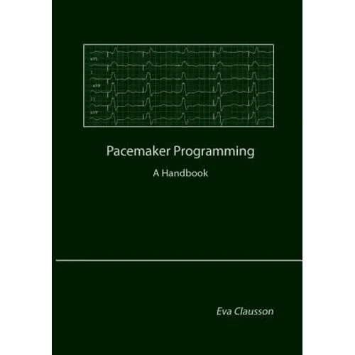 Pacemaker Programming: A Handbook - Paperback