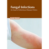 Fungal Infections: An Issue of Infectious Disease Clinics - Hardcover