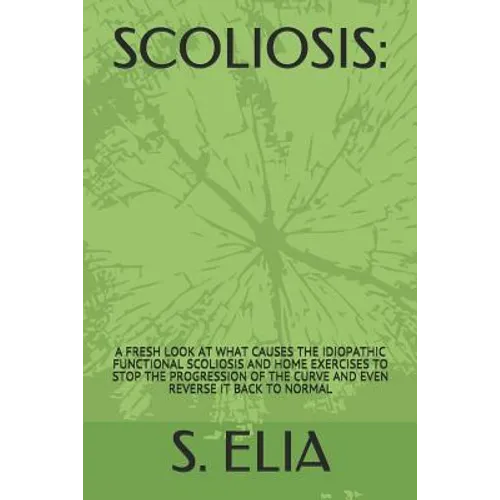 Scoliosis: : A Fresh Look at What Causes the Idiopathic Functional Scoliosis and Home Exercises to Stop the Progression of the Cu - Paperback