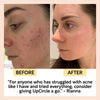 Travel-Size Skincare Bundle
