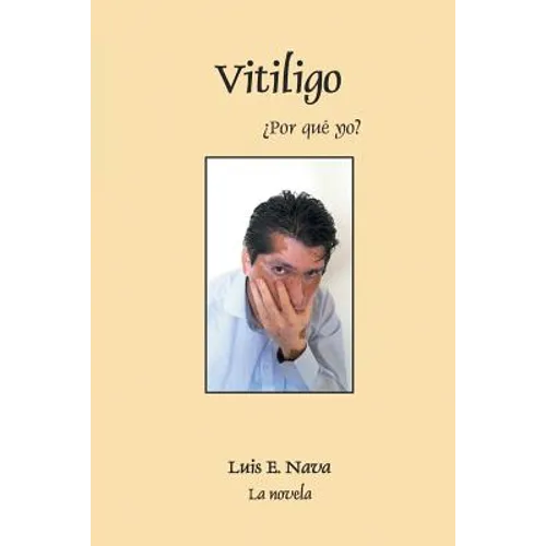 Vitiligo - Paperback
