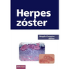 Herpes zóster - Paperback