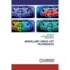 Maxillary Sinus Lift Techniques - Paperback