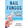 Nail Fungus: How to Naturally Cure Nail Fungus in 30 Days: Natural remedies, homeopathy for toenail fungus - Paperback
