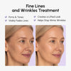 Anti-wrinkle Tape Patches