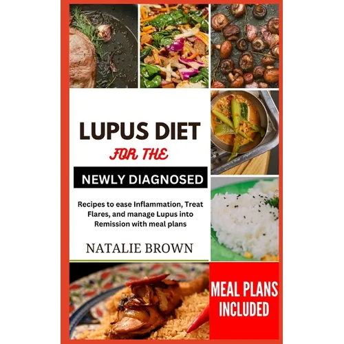 Lupus Diet for the Newly Diagnosed: Recipes to ease inflammation, Treat Flares and Manage lupus into remission with meal plans - Paperback