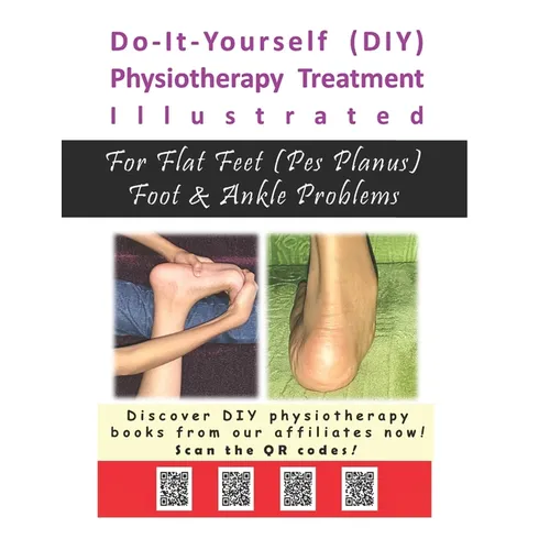 Physiotherapy Treatment Illustrated For Flat Feet (Pes Planus) Foot & Ankle Problems - Paperback