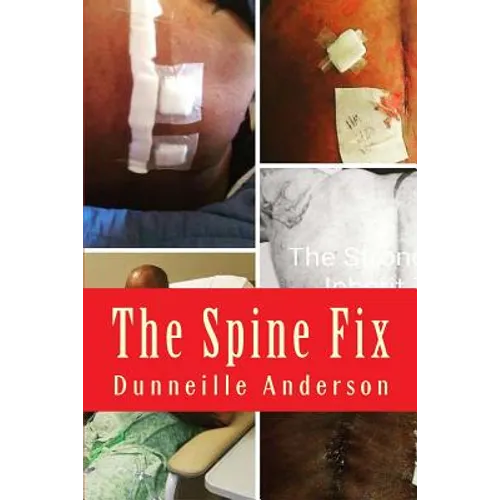 The Spine Fix: Life lessons on overcoming spinal surgery and improving your quality of life - Paperback