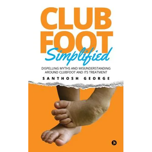 Clubfoot Simplified: Dispelling Myths and Misunderstanding around Clubfoot and its treatment - Paperback