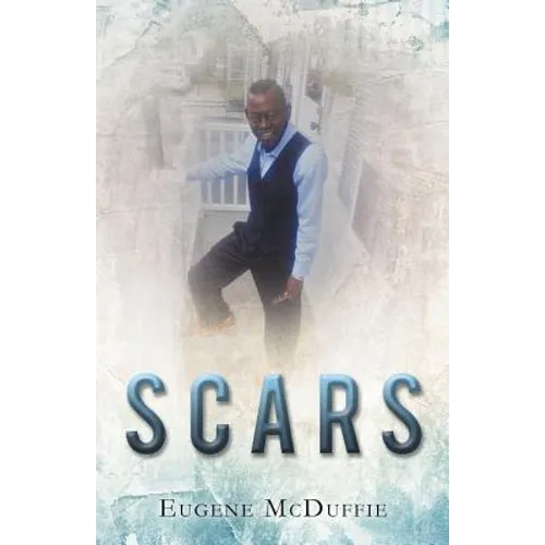 Scars - Paperback