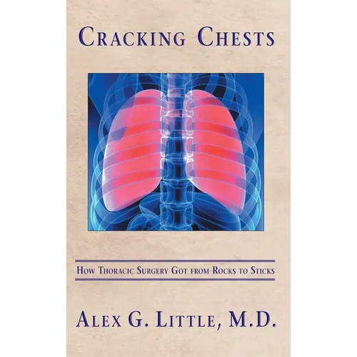 Cracking Chests: How Thoracic Surgery Got from Rocks to Sticks - Hardcover