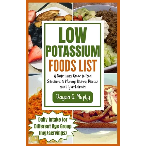 Low Potassium Foods List: A Nutritional Guide to Food Selections to Manage Kidney Disease and Hyperkalemia - Paperback