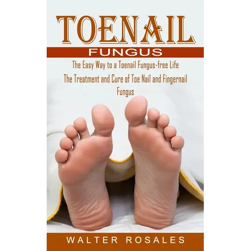 Toenail Fungus: The Easy Way to a Toenail Fungus-free Life (The Treatment and Cure of Toe Nail and Fingernail Fungus) - Paperback