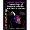 Transthoracic Echocardiography: Foundations of Image Acquisition and Interpretation - Paperback
