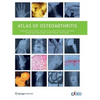 Atlas of Osteoarthritis - Paperback