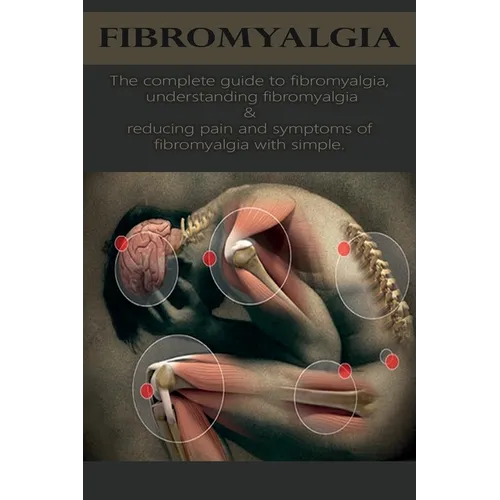 Fibromyalgia: The complete guide to fibromyalgia, understanding fibromyalgia, and reducing pain and symptoms of fibromyalgia with simple treatment met - Paperback