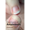 Encyclopedia of Amyloidosis - Hardcover