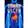 Stomach Ulcer: Treatment in 60 days!: Stomach Ulcer treatment - Paperback