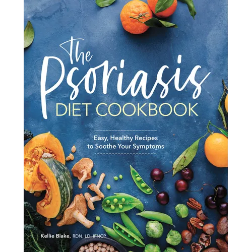 The Psoriasis Diet Cookbook: Easy, Healthy Recipes to Soothe Your Symptoms - Paperback