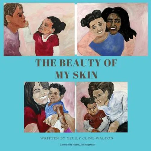 The Beauty of My Skin - Paperback