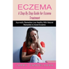 Eczema: A Step By Step Guide for Eczema Treatment (Ayurvedic Remedies Live Healthy With Natural Remedies to Avoid Eczema) - Paperback