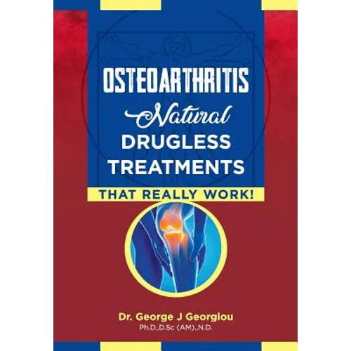 Osteoarthritis: Natural Drugless Treatments That Really Work! - Paperback