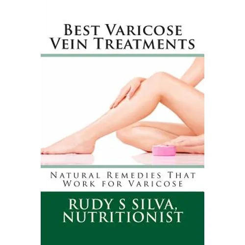 Best Varicose Vein Treatments: Natural Remedies That Work For Varicose - Paperback