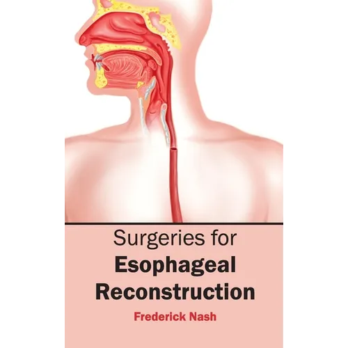 Surgeries for Esophageal Reconstruction - Hardcover