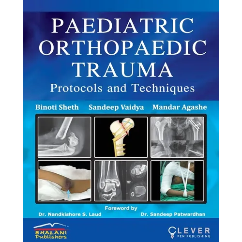 "PAEDIATRIC ORTHOPAEDIC TRAUMA Protocols and Techniques" - Paperback
